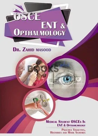 OSCE ENT & Opthalmology by Dr Zahid Masood