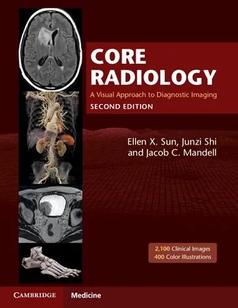 Core Radiology 2nd Edition