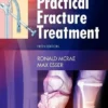 Practical Fracture Treatment 5th Edition